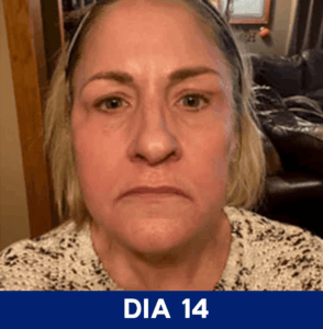 Dia-14.png